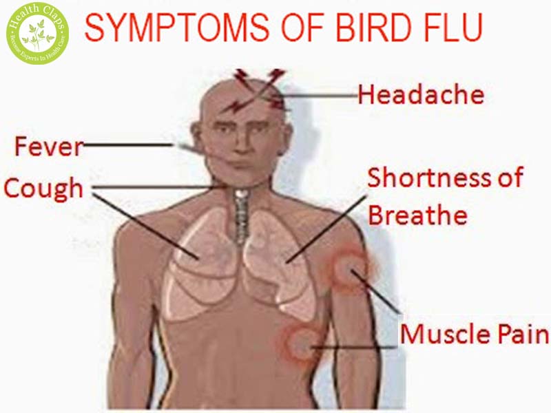 Bird Flu  Home Remedies
